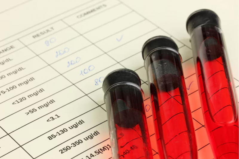 Onde Fazer Hemograma Completo e Garantir Resultados Confiáveis Onde Fazer Hemograma Completo e Garantir Resultados Confiáveis