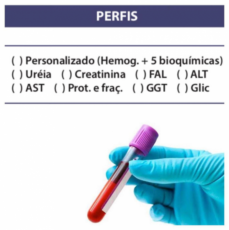 Hemograma Sangue Total Marcar Vila São Paulo - Hemograma Simples