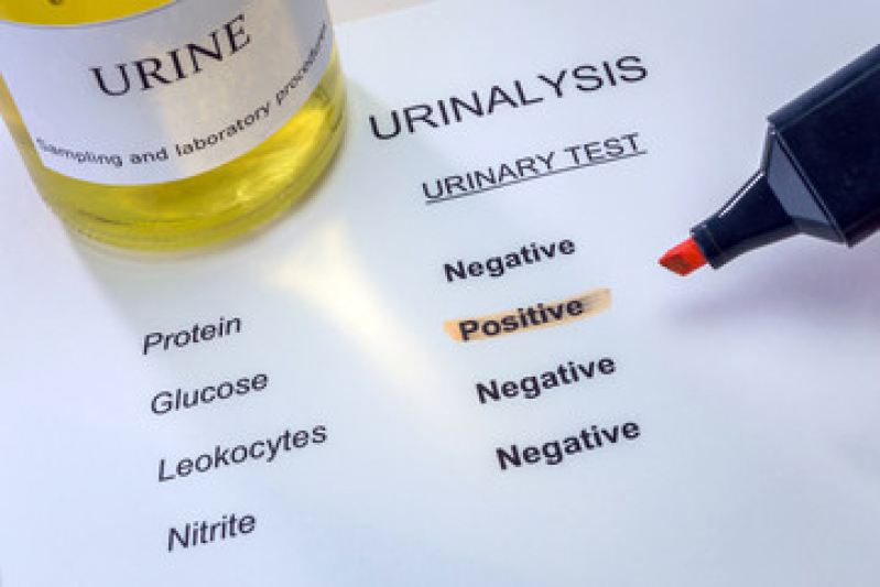 Onde Fazer Exame de Urinálise Animal Jussara - Exame Urina Sedimentoscopia