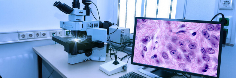 Onde Fazer Exame Histopatológico do Colo Uterino Cibratel 2 - Exame Histopatológico Mama